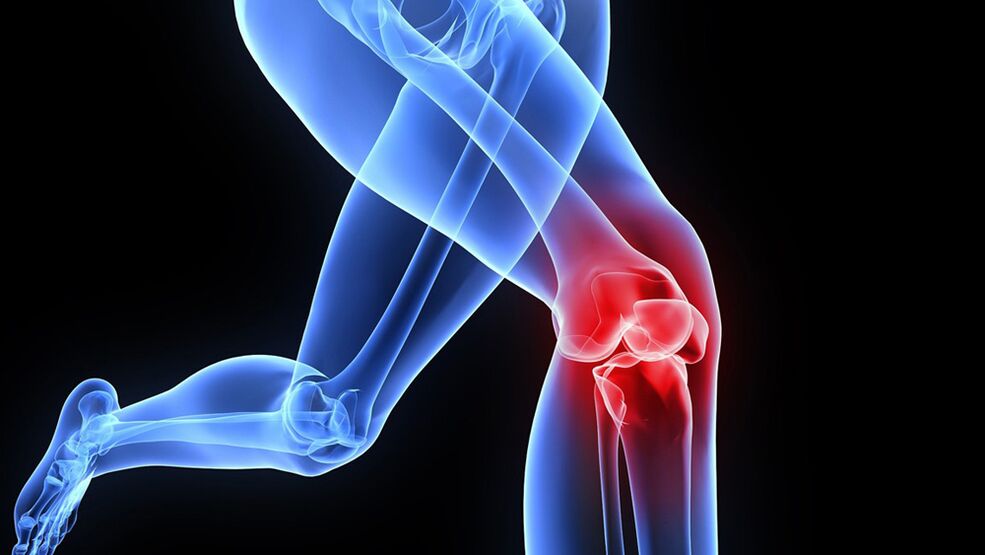 προβλήματα με τα γόνατα λόγω αρθροπάθειας